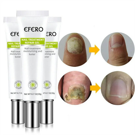 Efero® Nail Repair Gel: Beautiful Nails, Unmatched Confidence
