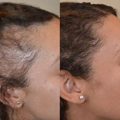 Botanic™ Natural Hair Oil - For Full, Healthy, and Radiant Hair