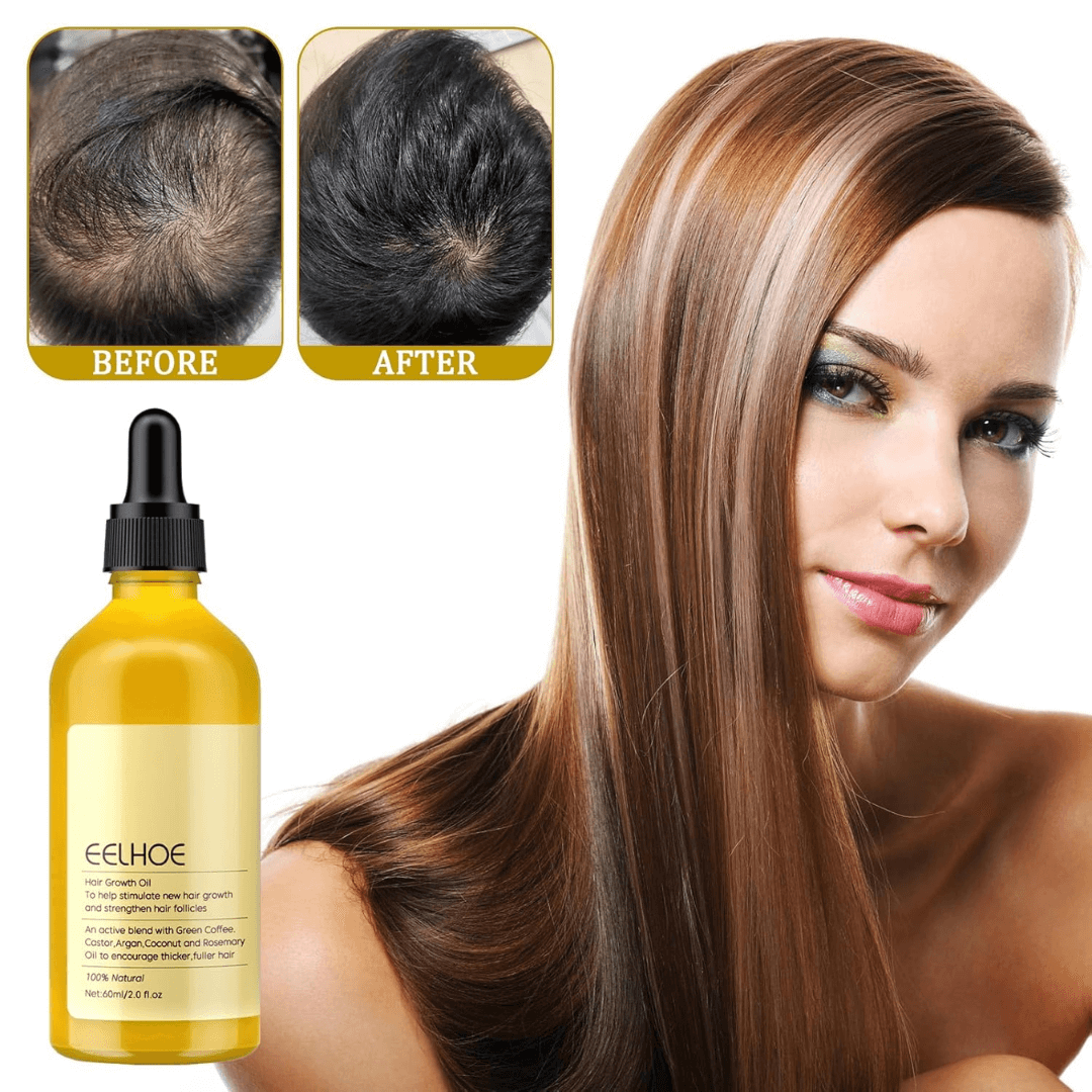 Eelhoe™ Natural Rosemary Hair Oil for Unmatched Confidence